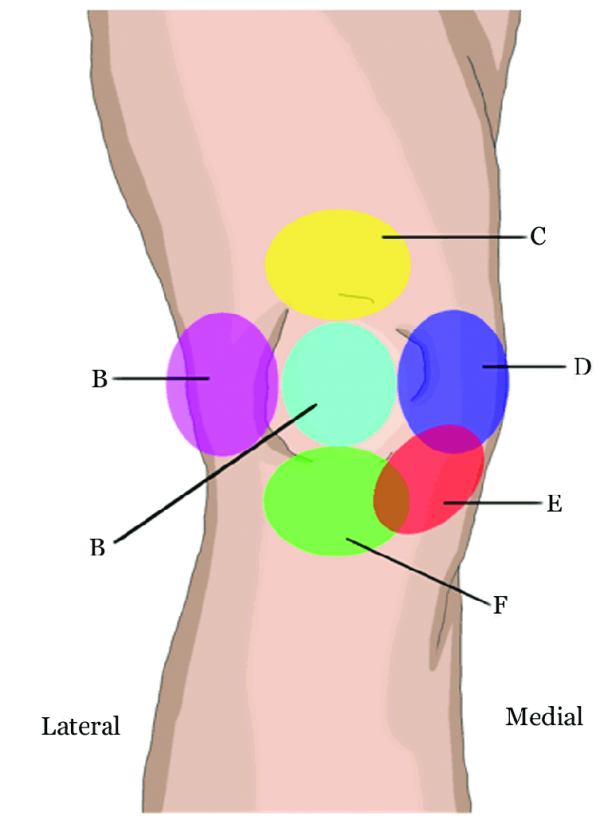 Self Diagnosing Knee Pain Vancouver Chiropractic Care