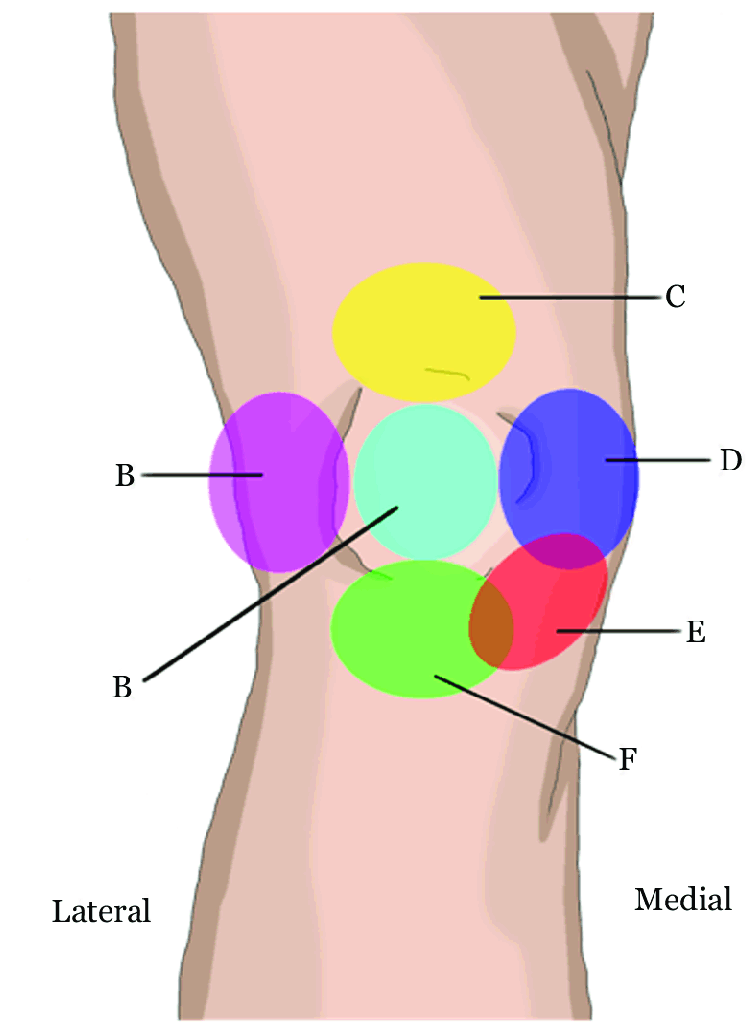 Self Diagnosing Knee Pain Vancouver Chiropractic Care