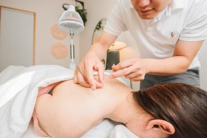 Acupuncture