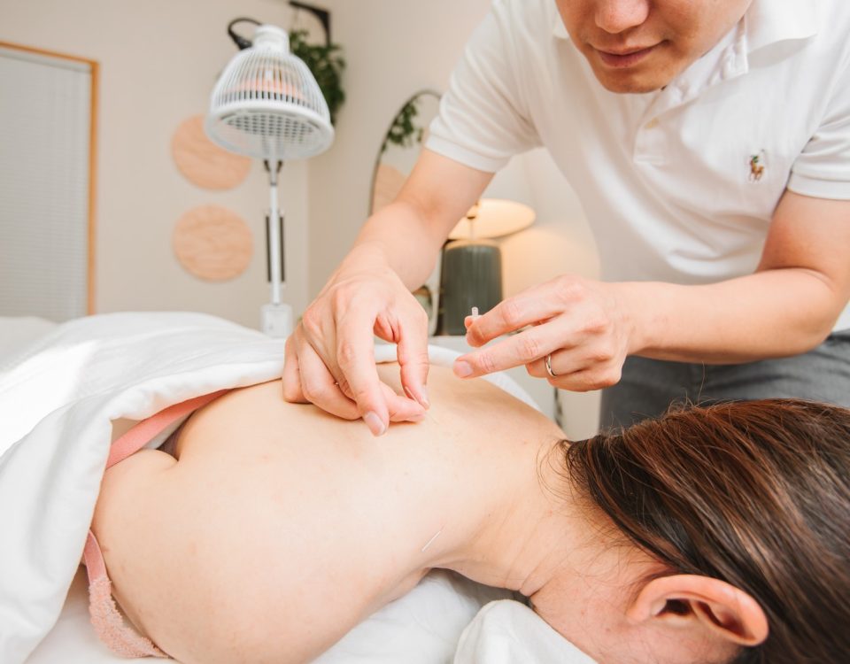 Acupuncture