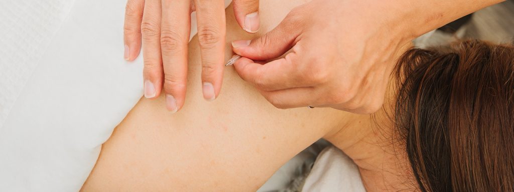 vancouver acupuncturist working with a patient