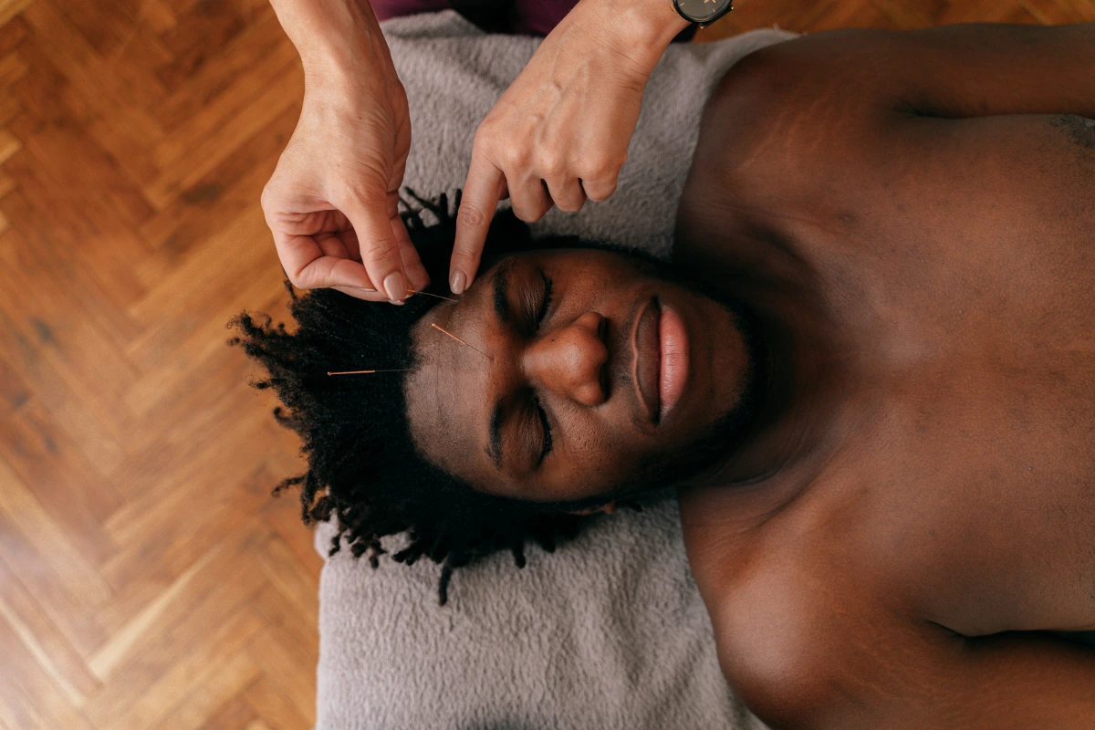 Man lying down reciving acupuncture needles into pressure point on his face in Vancouver.
